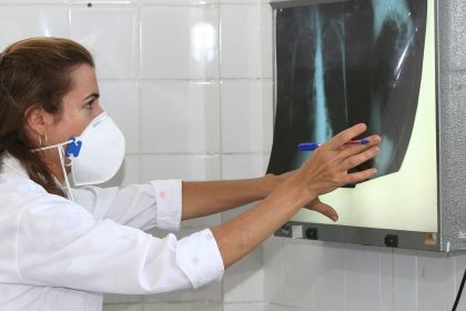 OMS recomenda testes de diagnóstico rápido para erradicar tuberculose