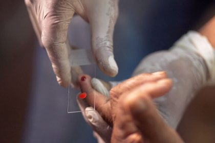 SUS começa a usar novo tratamento contra a malária em crianças